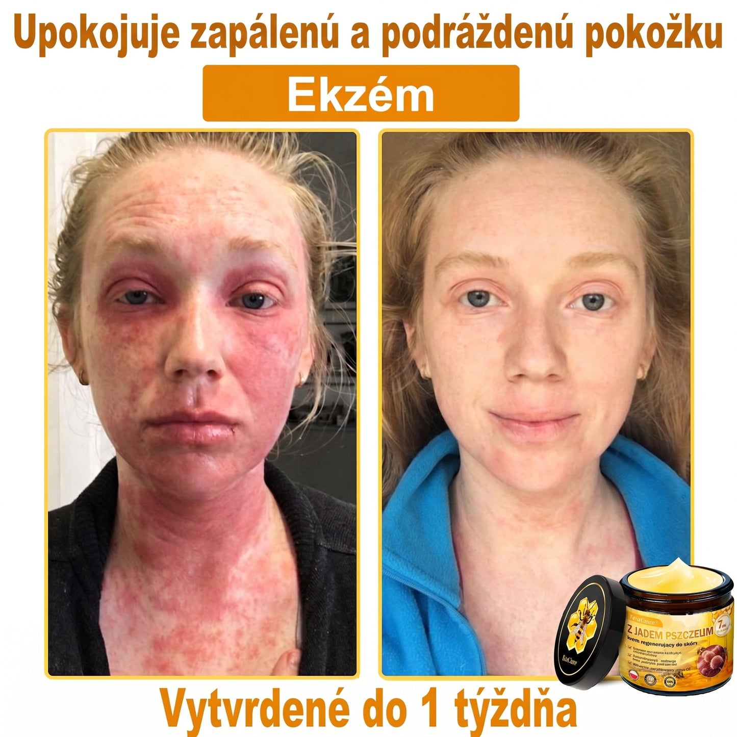 ✅✨PuraCure® Jad Pszczeli Regeneracja Skóry Krem(👨‍⚕‍CE zatwierdzone)👍✅