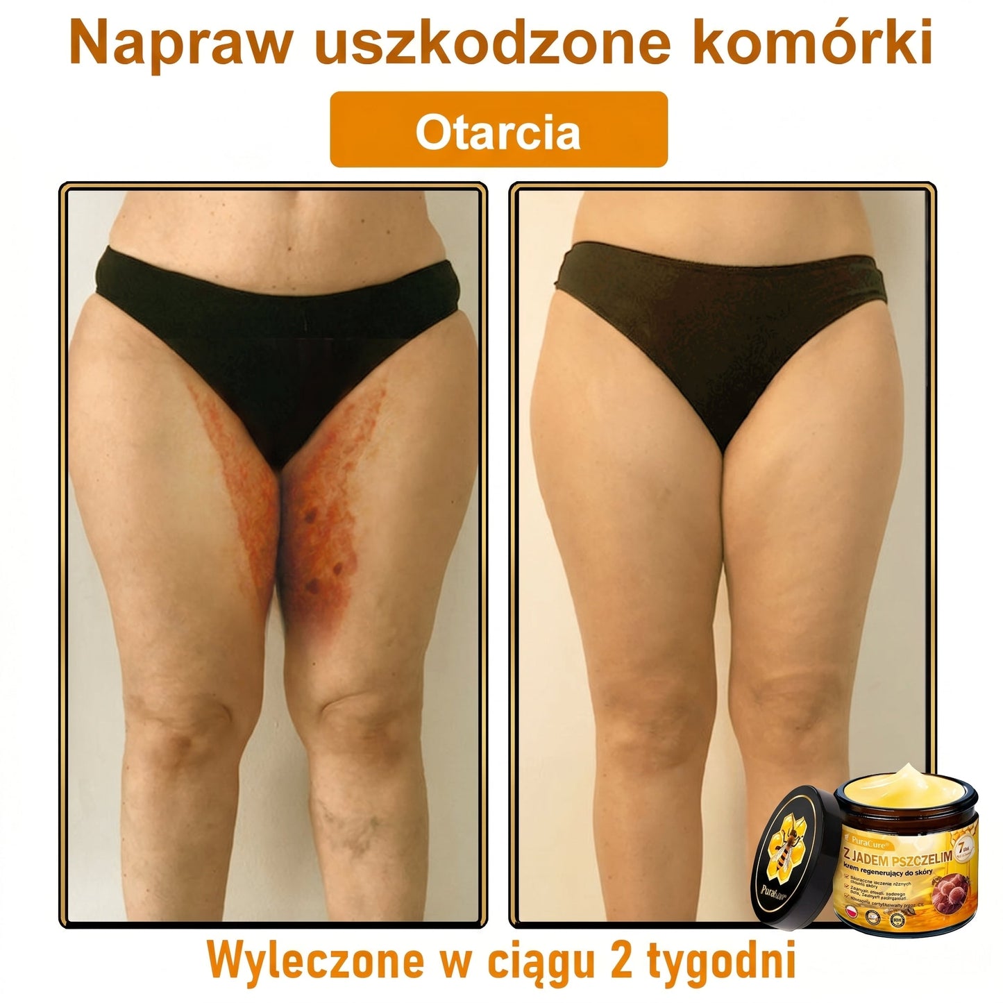 ✅✨PuraCure® Jad Pszczeli Regeneracja Skóry Krem(👨‍⚕‍CE zatwierdzone)👍✅