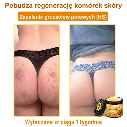✅✨PuraCure® Jad Pszczeli Regeneracja Skóry Krem(👨‍⚕‍CE zatwierdzone)👍✅