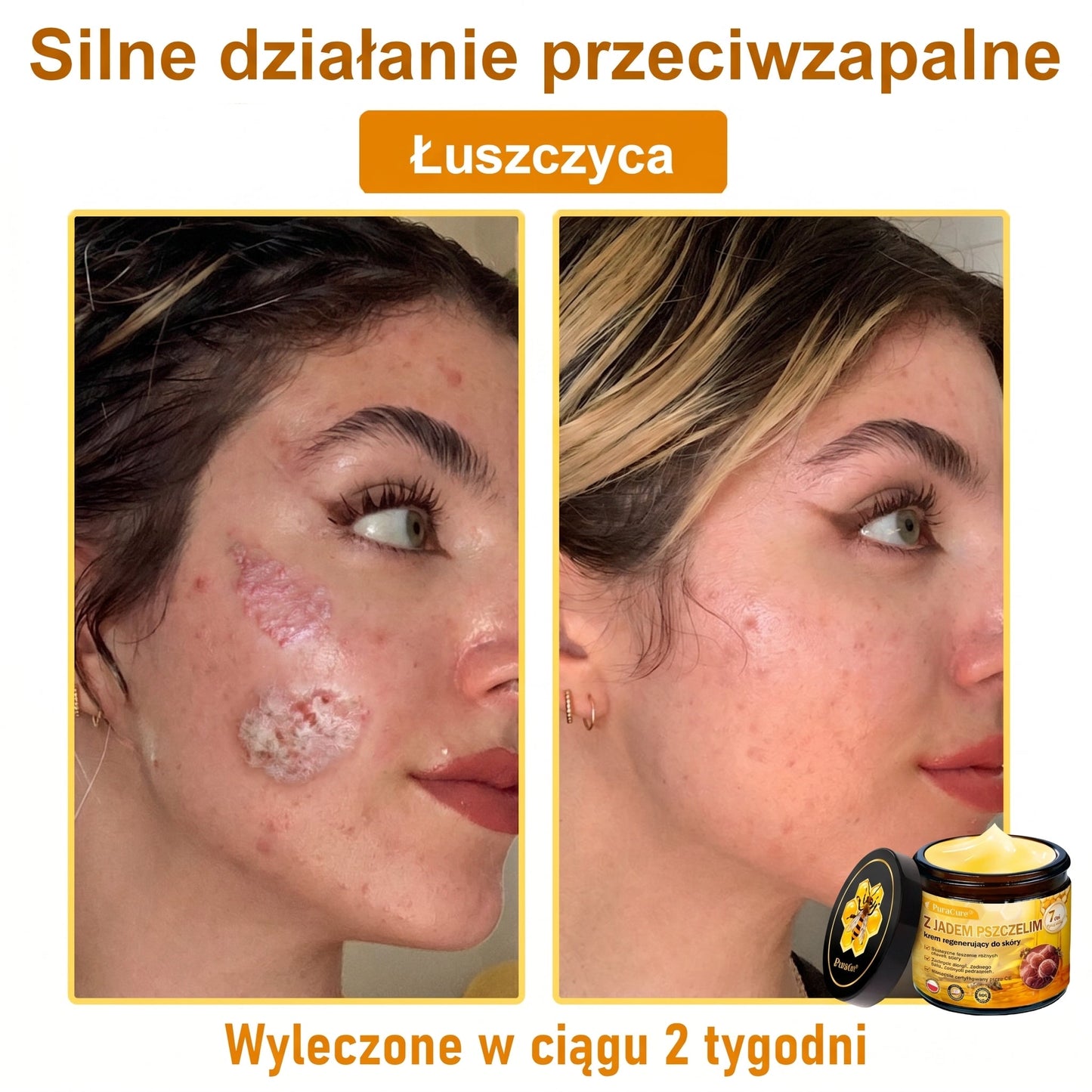 ✅✨PuraCure® Jad Pszczeli Regeneracja Skóry Krem(👨‍⚕‍CE zatwierdzone)👍✅
