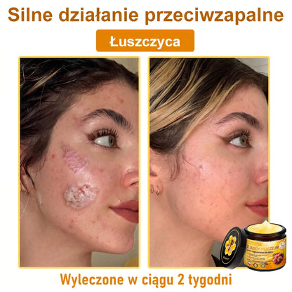 ✅✨PuraCure® Jad Pszczeli Regeneracja Skóry Krem(👨‍⚕‍CE zatwierdzone)👍✅